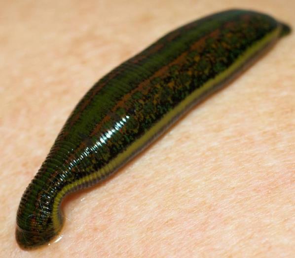 LIVE Leeches hirudo for home treatment use blood sucking