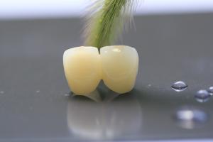 Wholesale 3D Print Framework PFM Dental Lab Crown For Dentistry from china suppliers