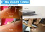 High Frequency Vascular / Spider Vein Removal Machine , Laser Varicose Vein