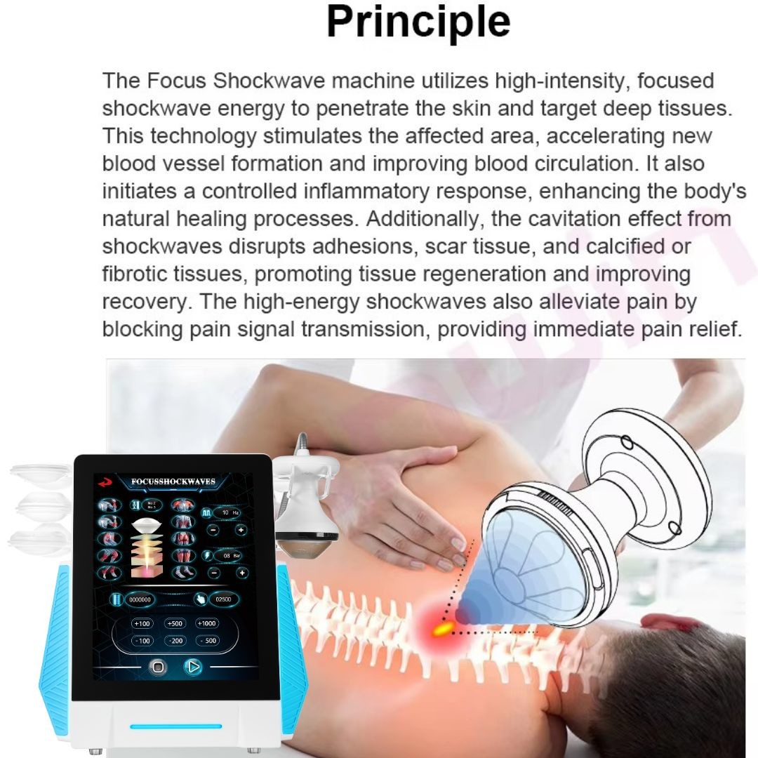Focused Shockwave Therapy Machine Focus Shock Wave Machine Physiotherapy Pain Relief Machine
