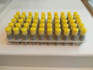 Wholesale High Strength Dental Filling Material Amalgam Alloy Capsule 43%Ag 32%Sn 25%Cu Powder from china suppliers