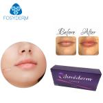 Ultra XC Hyaluronic Acid Dermal Filler Juvederm Lip Filler 24mg/Ml