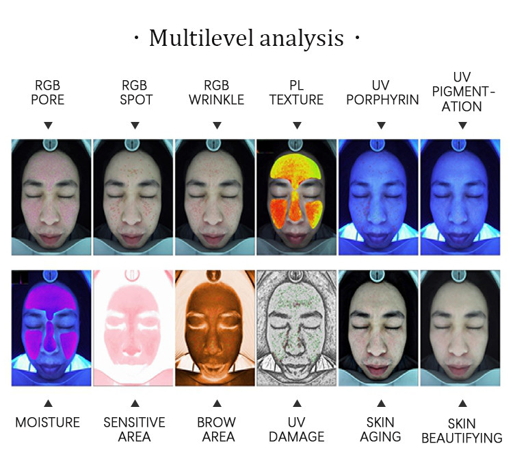 Android Software Skin Scanner UV Analysis Machine 9000h 1.8 G HZ CE Certification