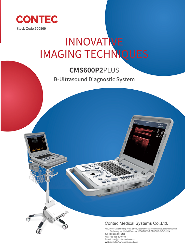 CONTEC CMS600P2 PLUS portable ultrasound machine pseudo color doppler medical ultrasound Pulse Spectral Doppler instru