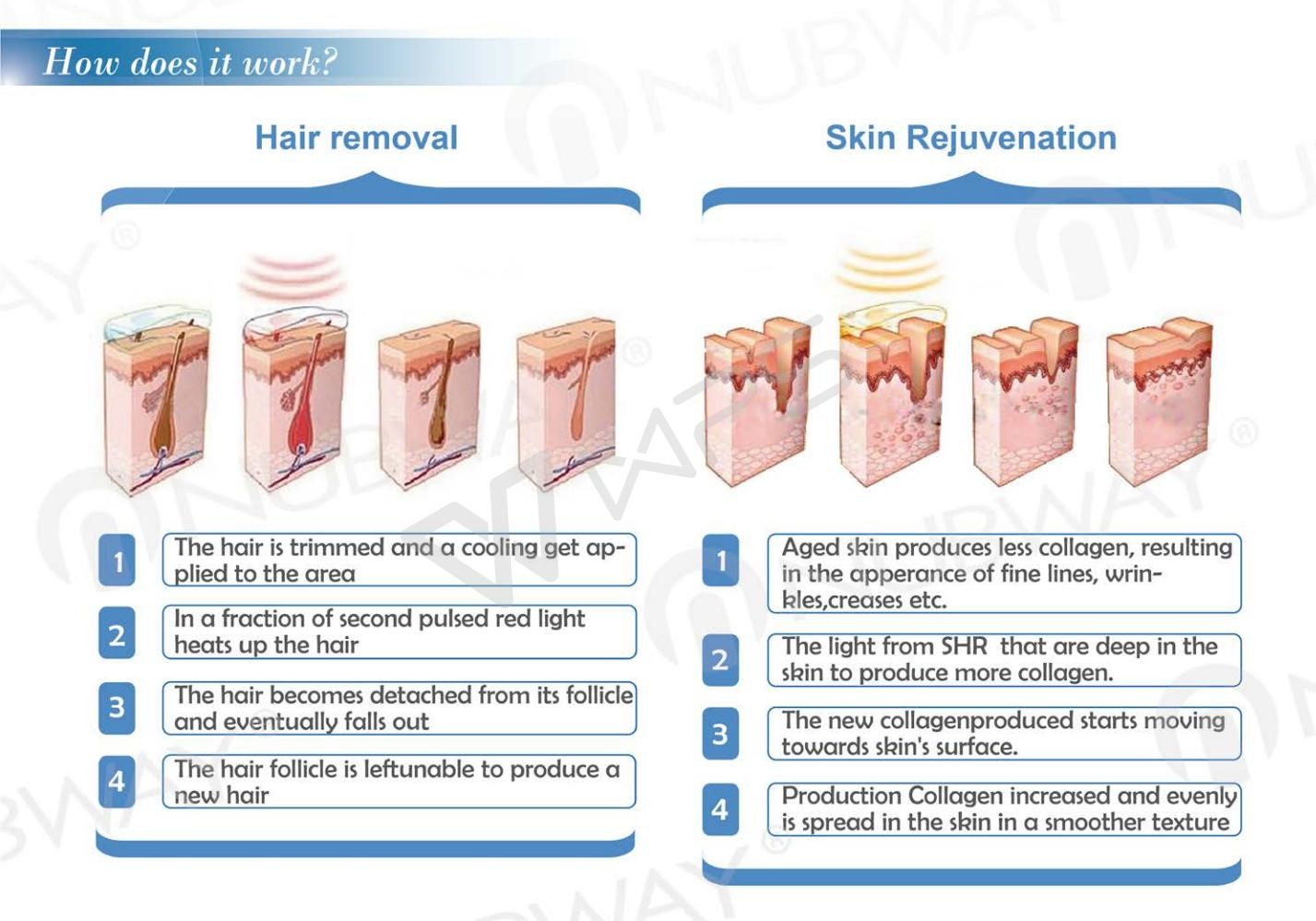 soprano diode laser skin hair removal ipl machine intense pulsed light machine