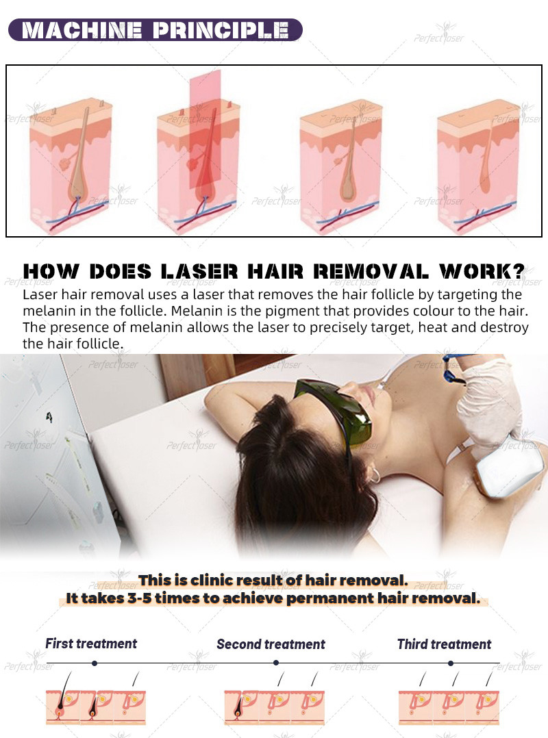 755nm / 1064nm Cooling Laser Hair Removal Machine with 2 Handles