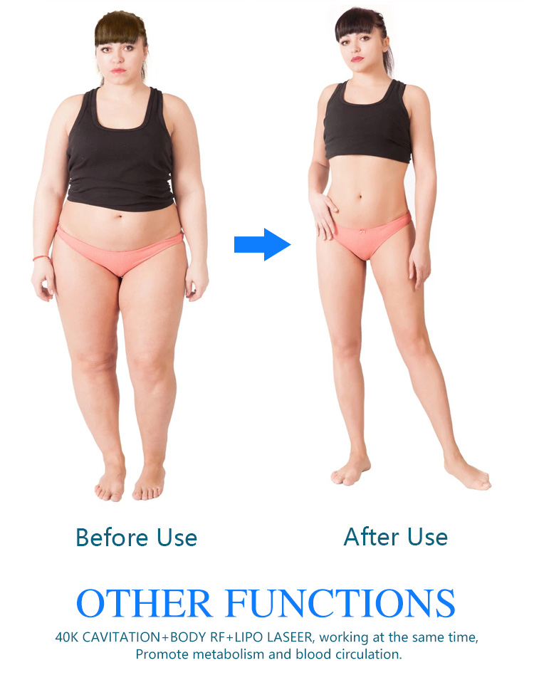 5 In 1 Cryotherapy Fat Freezing Machine 360 Cool Body Sculpting Slimming 650nm