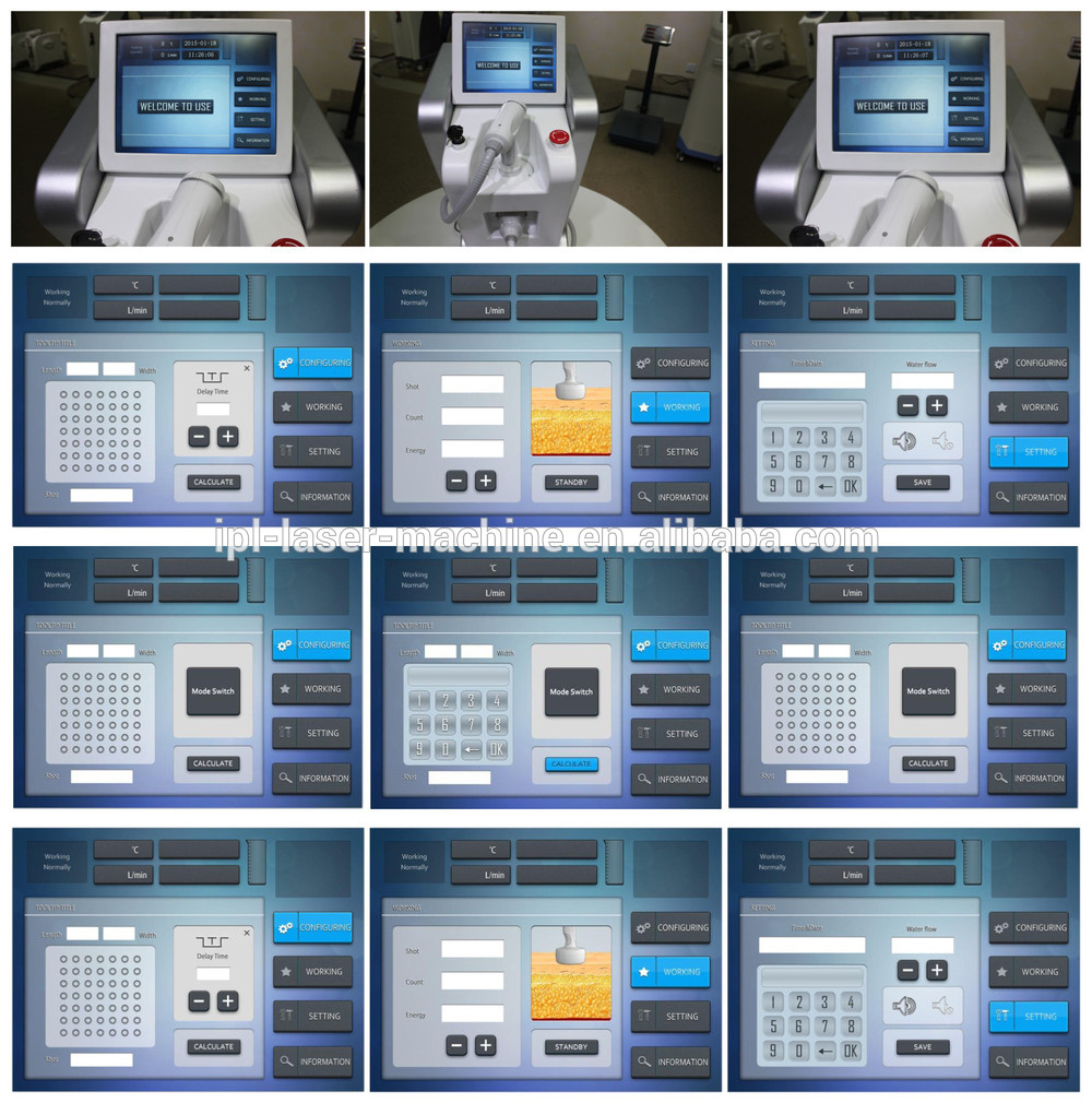 HIFU slimming machine screen NBW-HIFU200 4.jpg
