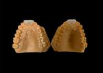 Customized Aesthetic Zirconia Dental Crown Perfectly Fitted for Anterior and