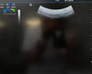 Wholesale Probe Repair Mindray Ultrasound Probe 3C5S Lens Replacement from china suppliers