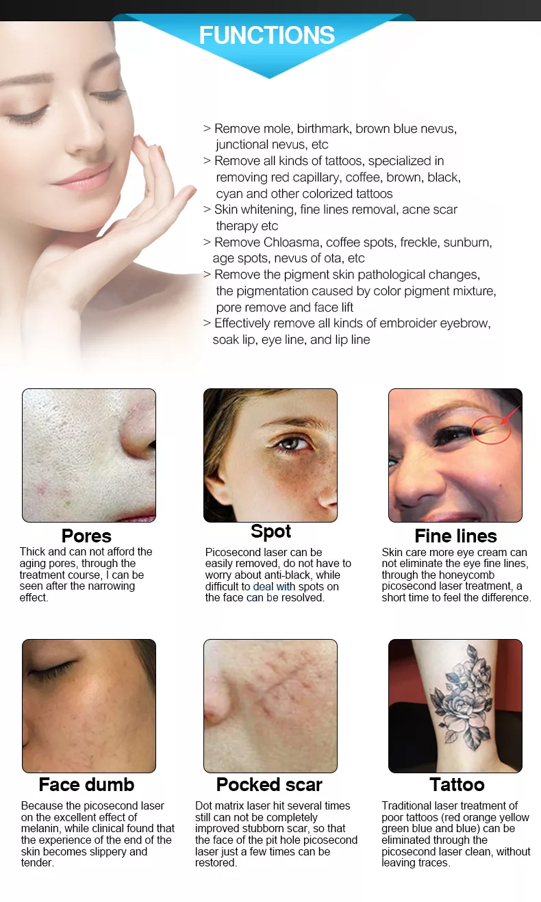 Q Switched Nd Yag Laser Eyebrow Removal Laser Picosecond Tattoo Removal Carbon Peel Machine Skin Rejuvenation Acne Removal
