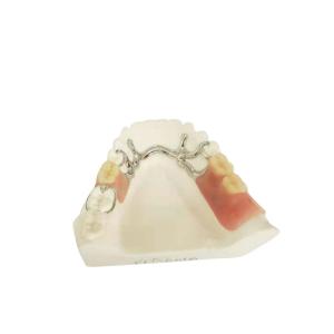 Wholesale Cocr Chrome Cast Removable Dental Crown Easy Clean Strong Hardness from china suppliers