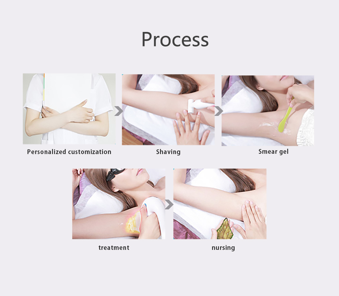 Canada MDSAP Approved Diode Laser Hair Removal Machine 3 Wavelengths 810nm/755nm/1064nm