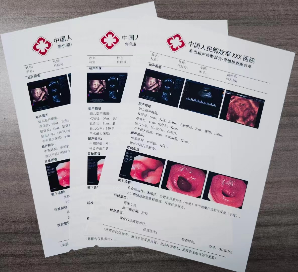 Radiology film x-ray medical x-ray white film for image printing