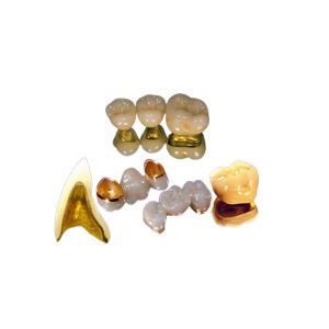Wholesale Color Stable PFM Full Crown High Strength Beautiful Appearance from china suppliers