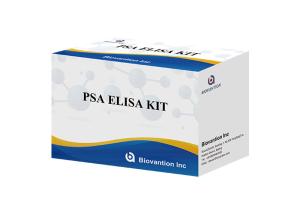Wholesale High Accuracy Total PSA Prostate-Specific Antigen Elisa Test Kit from china suppliers