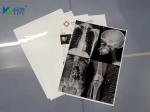 Radiology Films x rays Medical x-ray White Film For Digital Printing