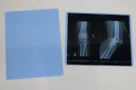 Blue PET Inkjet Medical X Ray Film For Epson Printer