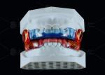Medical Grade Silicone Anti Snoring Appliance RP For Improved Sleep