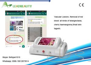 Wholesale 30MHz RBS high frequency portable vein / vascular spider vein removal machine from china suppliers