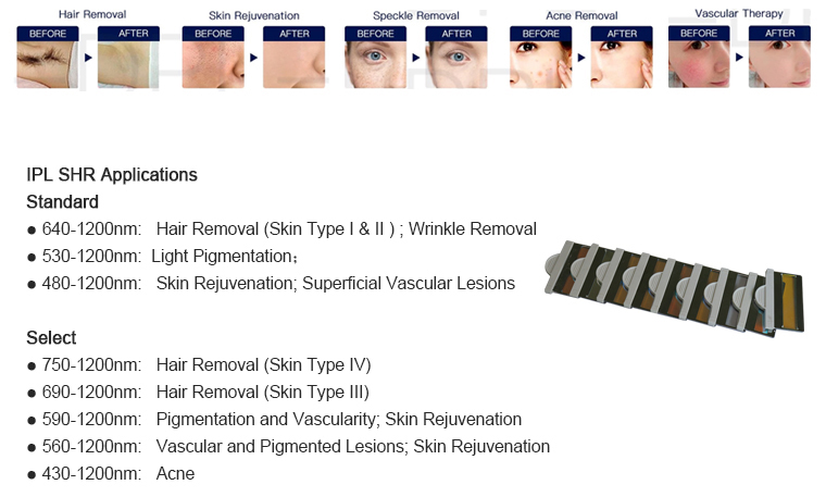 CE Approved Facial Equipment Intense Pulse Light OPT IPL Laser Hair Removal Device