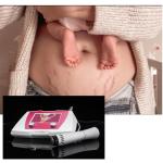 Salon Use Acoustic Wave Therapy Machine For Cellulite Treatment Muscle Relax