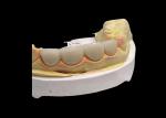 Long lasting Wear resistant Strength all Ceramic Crown Bridge with Excellent