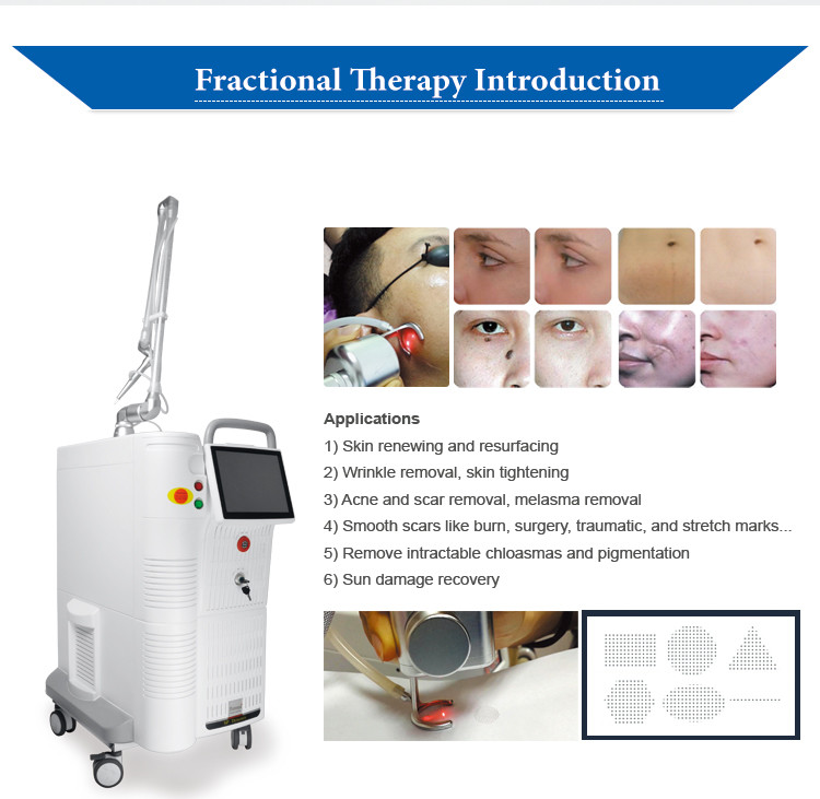 4d Fotona Skin CO2 Fractional Laser Machine For Vaginal Warts Stretch Marks Removal