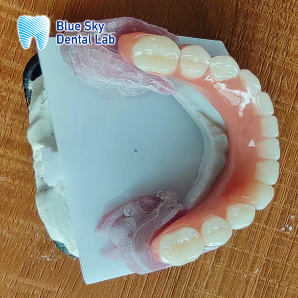 Missing Teeth Acrylic full Denture Restoration Acrylic Complete Denture