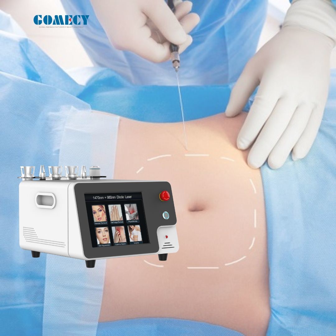 Portable Sugery Diode Laser Machine Endolaser 980 1470nm For Face Lift Laser Liposuction Weight Loss Endolaser