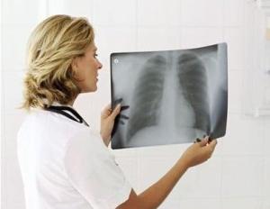 Wholesale 20cm X 25cm X Ray Diagnostic Imaging from china suppliers