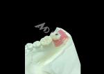 Long-lasting Dental Implant Crowns Revolutionizing Restorative Dentistry