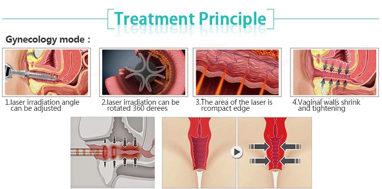 High Quality Fractional CO2 Laser scar removal beauty equipment