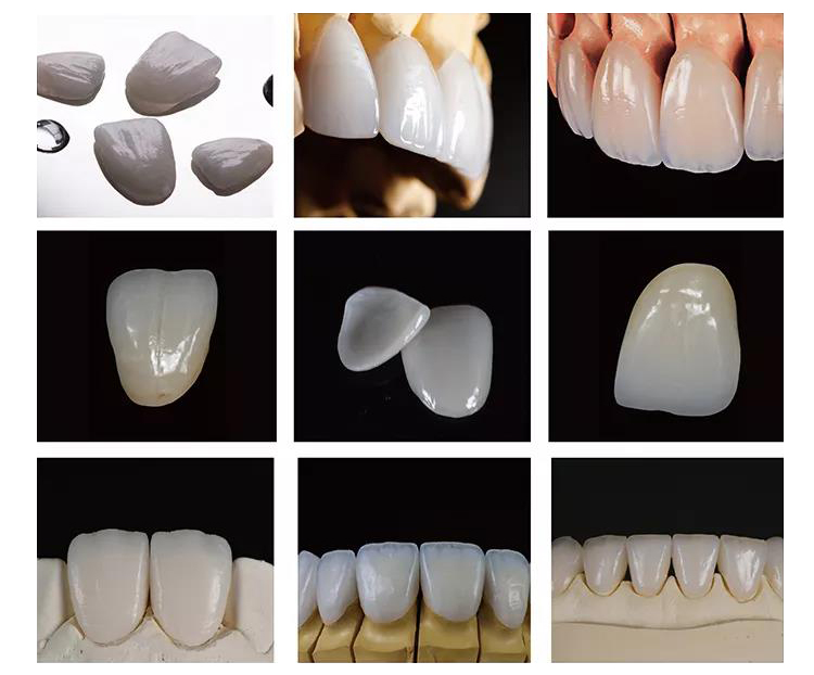 360Mpa ~ 400Mpa Class II Dental Lithium Disilicate Zirconia Glass Ceramic