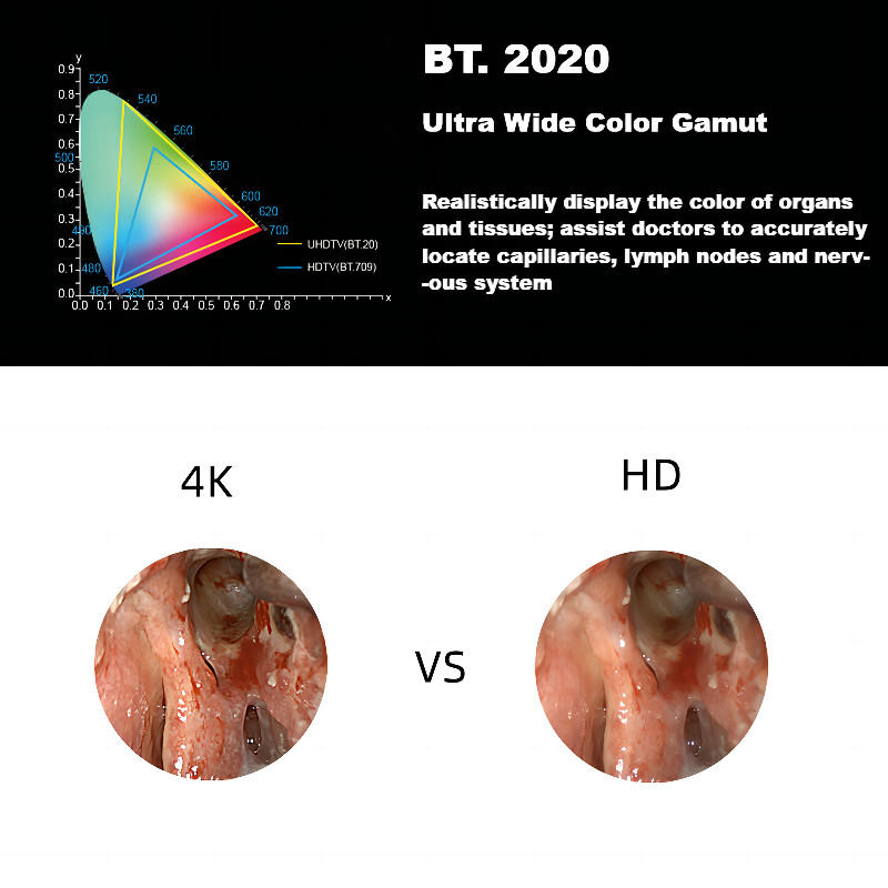 DEC 3840A New 4K Ultra HD Medical Endoscope Camera System For Laparoscopy