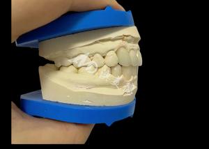 Wholesale Unbeatable Strength Dental Zirconia Dentla Crown For Natural Looking Smiles from china suppliers