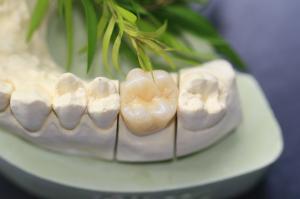 Wholesale Design Dental Lab Monolithic Zirconia Dental Crown For Molars Posterior Teeth from china suppliers