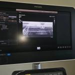 Repair ATL Affiniti50 Affiniti70 Original Acquisition Module ACQ 4535161610416