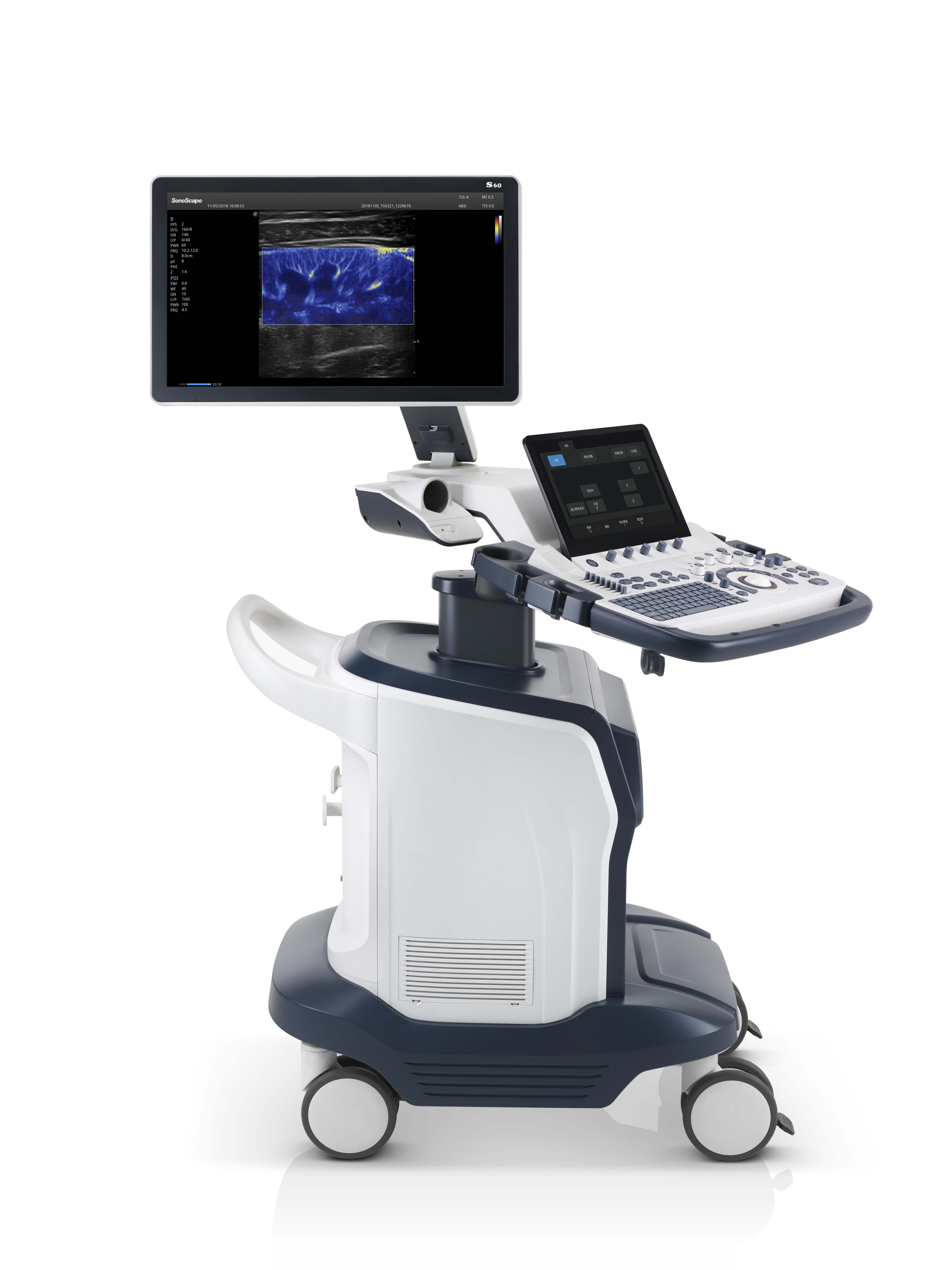 Sonoscape S60 Ecografo Sonoscape Ultrasound Machine Cw Tdi Software For Free