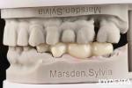 Excellent White Product Full Zirconia With High Resistance To Corrosion