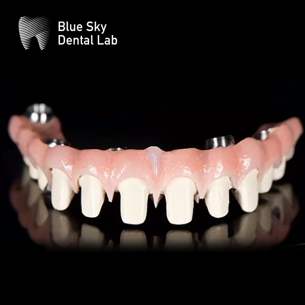 Metal Frame Titanium Malo Bridge Customizable Malo Implant Bridge