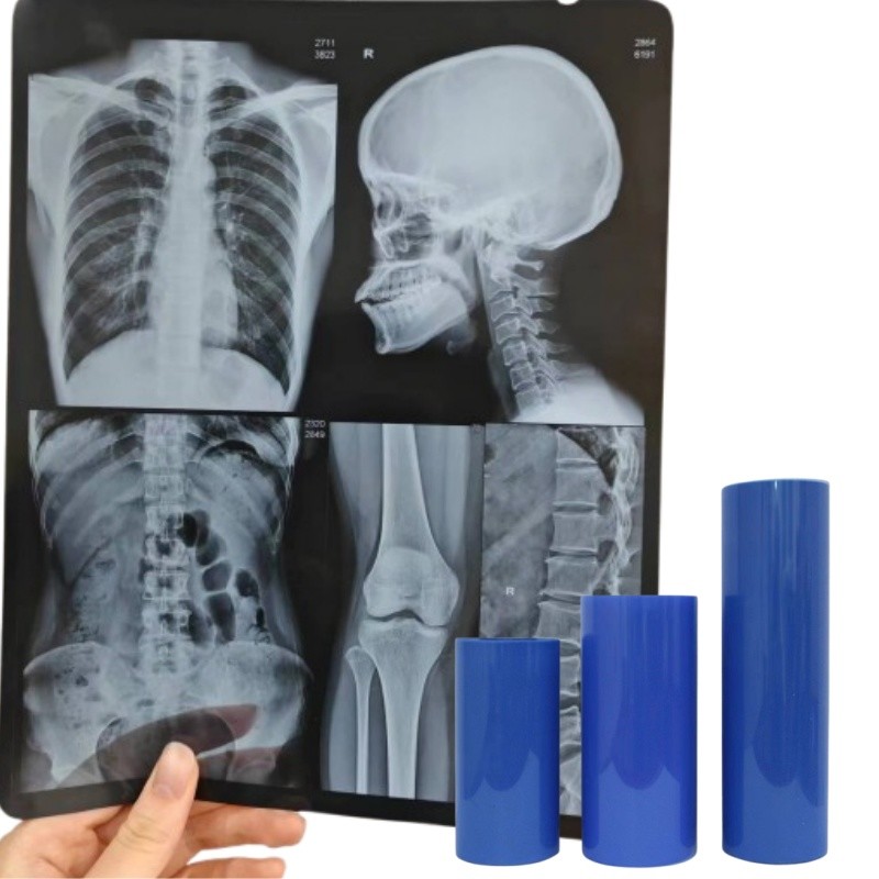 Inkjet Printer Use Sheet Roll Blue Xray Film PET Medical Film