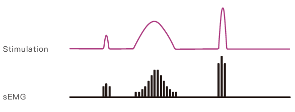 High Speed Emg Biofeedback Equipment Customize Treatment For Stroke Patients
