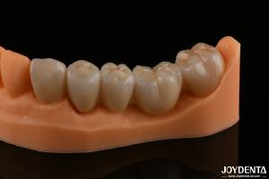 Wholesale Precision Dental Restorations Full Zirconia High Flexural Strength Natural Color from china suppliers