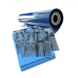 Wholesale Blue Medical Film Inkjet For Consistent X Ray Imaging Results from china suppliers
