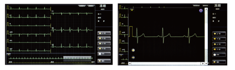 Ecg Machine 18 Channel Wifi Ecg Machine For Icu Hospital