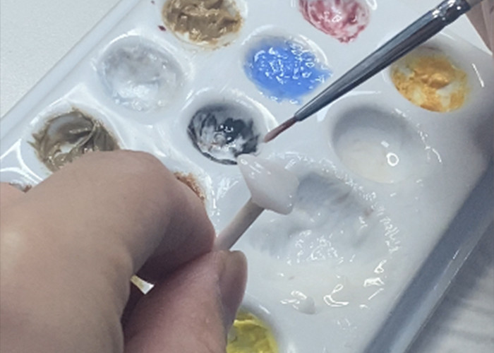 IPS emax Press Porcelain Veneers Achieve a Natural and Radiant Smile