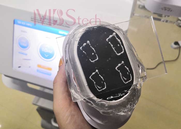 4Mhz 5D Ice Combine Anti Puffiness HIFU Facial Machine