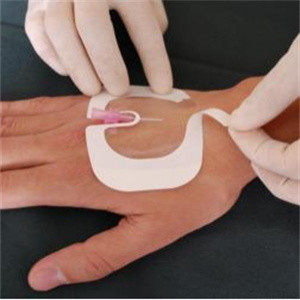 Hospital Disposable Transparent Adhesive Film Dressing Transfusion Needle