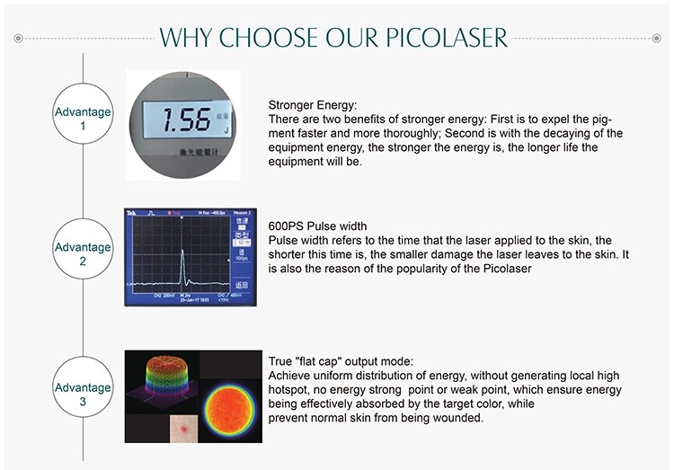 2019 new trending age spot freckle removal picosecond laser manufacturers